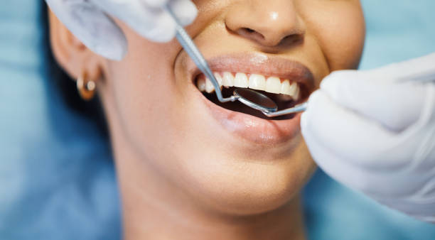 Best Knocked-Out Tooth (Avulsed Tooth) Treatment in Franklin, MI